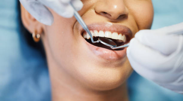 Best Emergency Dental Care for Broken or Chipped Teeth in Bessemer City, NC