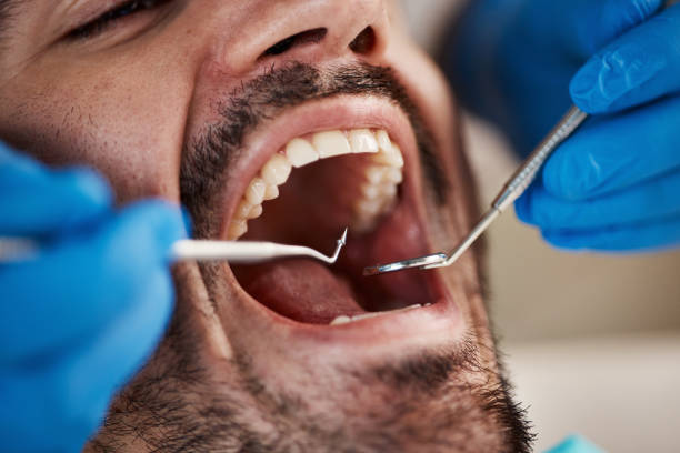 Best Emergency Tooth Extraction in Bessemer City, NC
