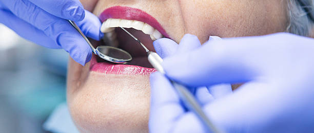 Best Emergency Tooth Extraction in Bessemer City, NC